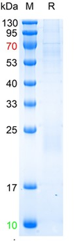 Recombinant mouse IL-21 protein, C-His Tag (HEK293)