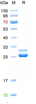 Recombinant human PRL protein, N-His (HEK293)