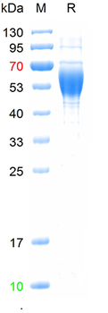 Recombinant human PAF Acetylhydrolase, His (HEK293)