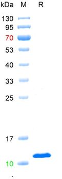 Recombinant human Beta-2-microglobulin, C-His (HEK293)