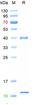 Recombinant human HLA-C & Beta-2-MG Heterodimer protein, C-His (HEK293)