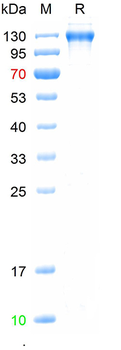 Recombinant human IL-6R-Beta protein, C-hFc-His (HEK293)