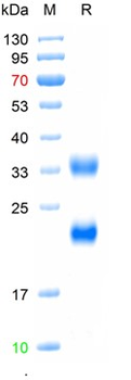 Recombinant human HCG Alpha / Beta protein, C-His (HEK293)