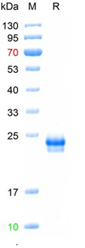 Recombinant human IL-6 protein, C-His (HEK293)