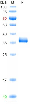 Recombinant SARS-Cov-2 (Omicron, B.1.1.529) Spike RBD protein (G339D, S371L, S373P, S375F, K417N, N440K, G446S, S477N, T478K, E484A, Q493R, G496S, Q498R, N501Y, Y505H), C-His (HEK293)