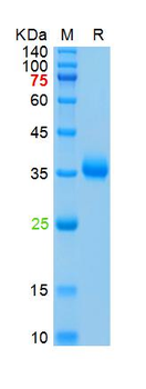 Recombinant SARS-Cov-2 Spike RBD protein, His (HEK293)