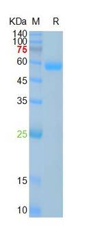 Recombinant SARS-Cov-2 Spike RBD protein, mFc (HEK293)