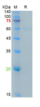 Recombinant SARS-Cov-2 Spike RBD protein, mFc (HEK293)