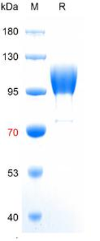 Recombinant human ACE2 protein, His (HEK293)