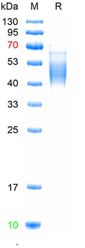Recombinant human IL-7R Alpha / CD127 protein, His (HEK293)