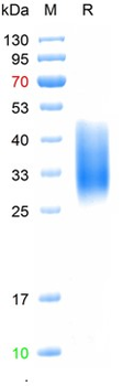 Recombinant human TIM-3 protein, His (HEK293)