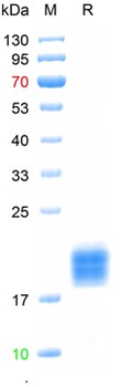 Recombinant human TIGIT protein, His (HEK293)