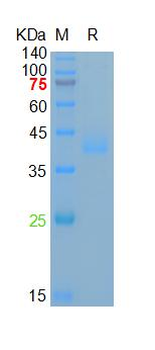 Recombinant human Azurocidin, His (HEK293)