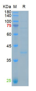 Recombinant human Apolipoprotein E protein, C-His (HEK293)