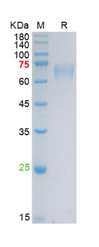 Recombinant human IL-6R Alpha protein, His (HEK293)