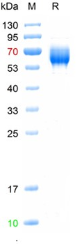 Recombinant human ST2 protein, His (HEK293)