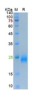 Recombinant mouse IL-1 Alpha protein, His (HEK293)