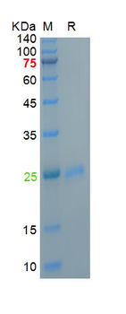 Recombinant human IL-1 Alpha protein, His (HEK293)