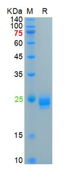 Recombinant human IL-1 Alpha protein, His (HEK293)