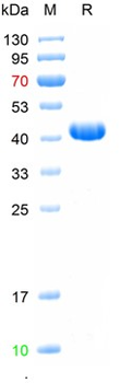 Recombinant human Mesothelin, N-His