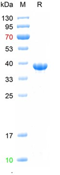 Recombinant human THRB protein, N-His
