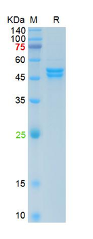 Recombinant SARS-Cov-2 N protein (R203M, D377Y), His
