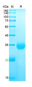 Recombinant SARS-Cov-2 Spike RBD protein (L452R), His (HEK293)