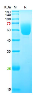 Recombinant human AXL protein, His (HEK293)