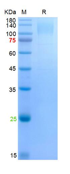 Recombinant SARS-Cov-2 Spike S1 protein (69/70 deletion, 144Y deletion, N501Y, A570D, D614G, P618H), His (HEK293)