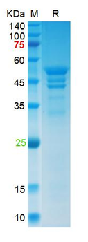 Recombinant SARS-Cov-2 N protein (D3L, P13T, D103Y, D128Y, H145Y, R203K, G204R, T205I, S235F), His