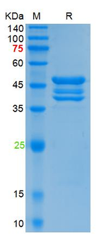 Recombinant SARS-Cov-2 N protein (Q9H, P67S, P80R, P151L, S183Y), His