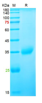 Recombinant SARS-Cov-2 Spike RBD protein (E417N, E484K, N501Y), His