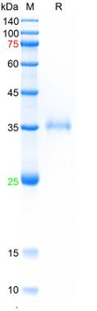 Recombinant SARS-Cov-2 Spike RBD protein (E417N, E484K, N501Y), His