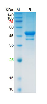 Recombinant SARS-Cov-2 N protein, C-His