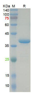 Recombinant SARS-Cov-2 N protein, DsbC & His