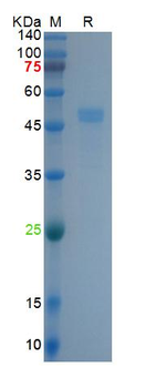 Recombinant SARS-Cov-2 Spike RBD protein, DsbC & His