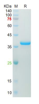 Recombinant mouse GAPDH protein, His