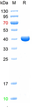 Recombinant human Lck protein isoform 3 , N-His
