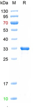 Recombinant human FAPA protein, His