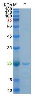Recombinant SARS-Cov-2 N protein, N-His