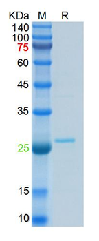 Recombinant SARS-Cov-2 N protein, N-His