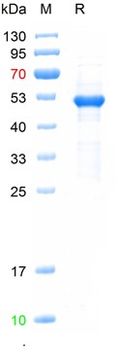 Recombinant HCoV-NL63 protein, His