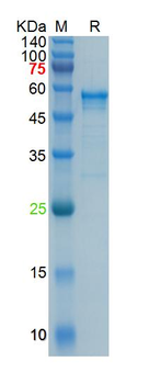 Recombinant hCoV-OC43 N protein, His