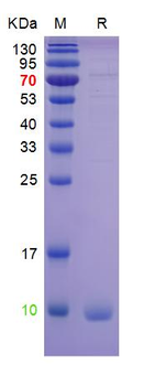 Recombinant human S100B protein, N-His
