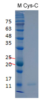 Recombinant human Cystatin-C protein, His