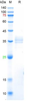 Recombinant human MMP9 protein, His
