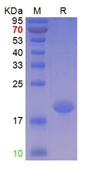 Recombinant human TTR / Prealbumin, N-His
