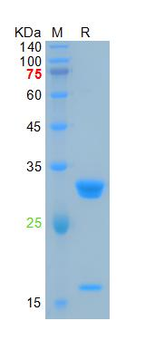 Recombinant RFP protein, His