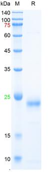 Recombinant mouse IL-6 protein, C-His