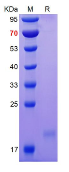 Recombinant human VEGF165 protein, C-His